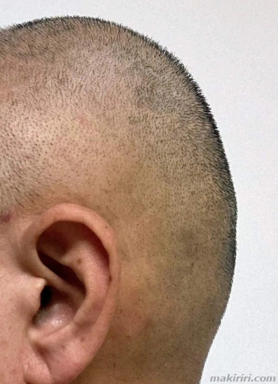 PHILIPS フィリップス 3000 HC3530/60 １ｍｍカット